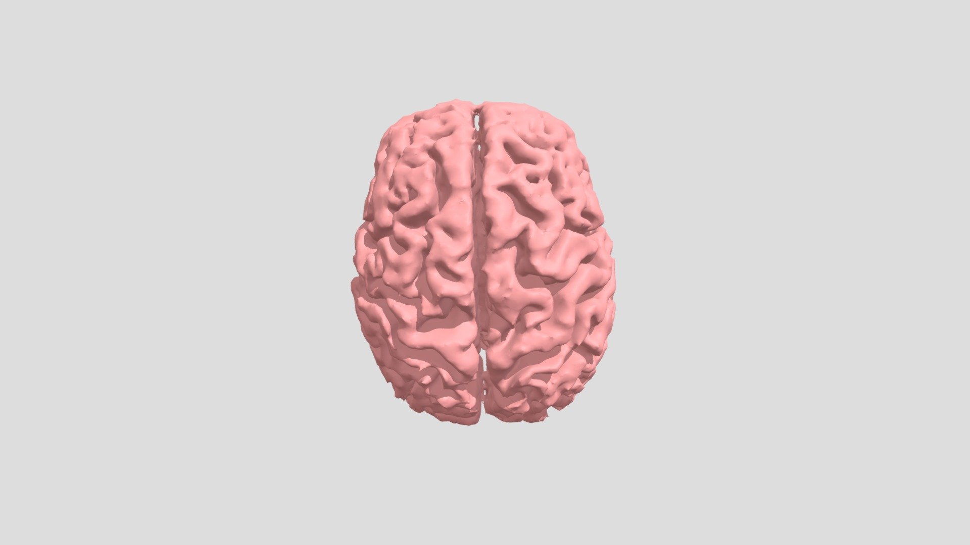 Parkinson's Brain
