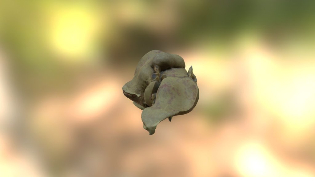 DSLR Liver-1