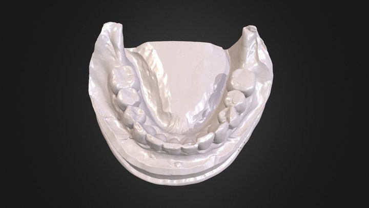 Mandibular Arch Case LL 3D Model