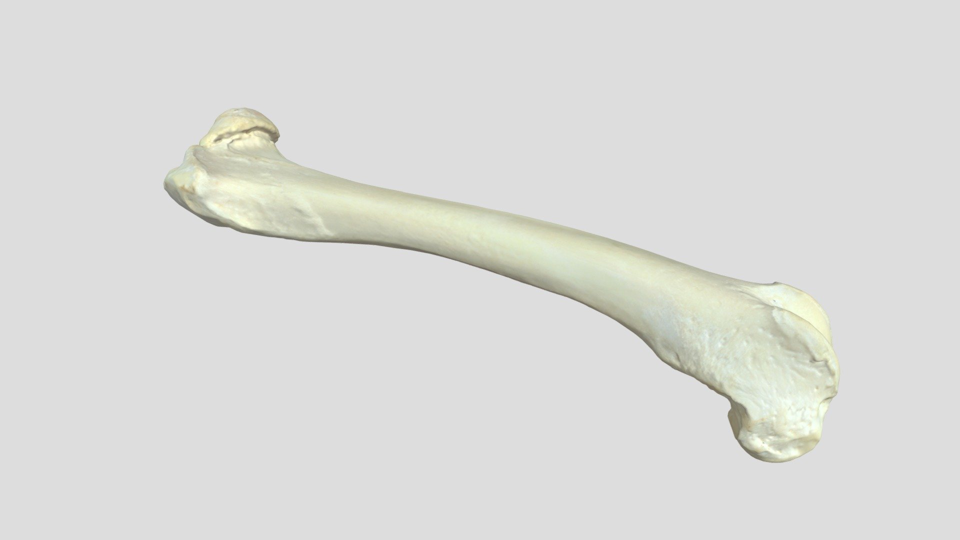 Femur 10%