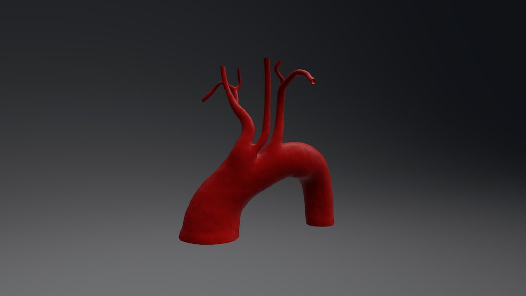 Bovine aortic arch