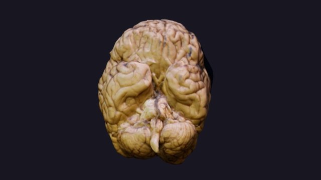 Normal Brain 3D Model