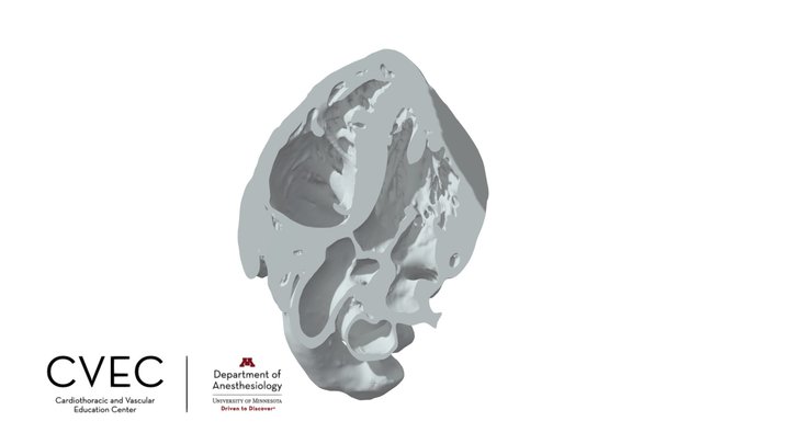 TEE Deep TG 5-chamber 3D Model