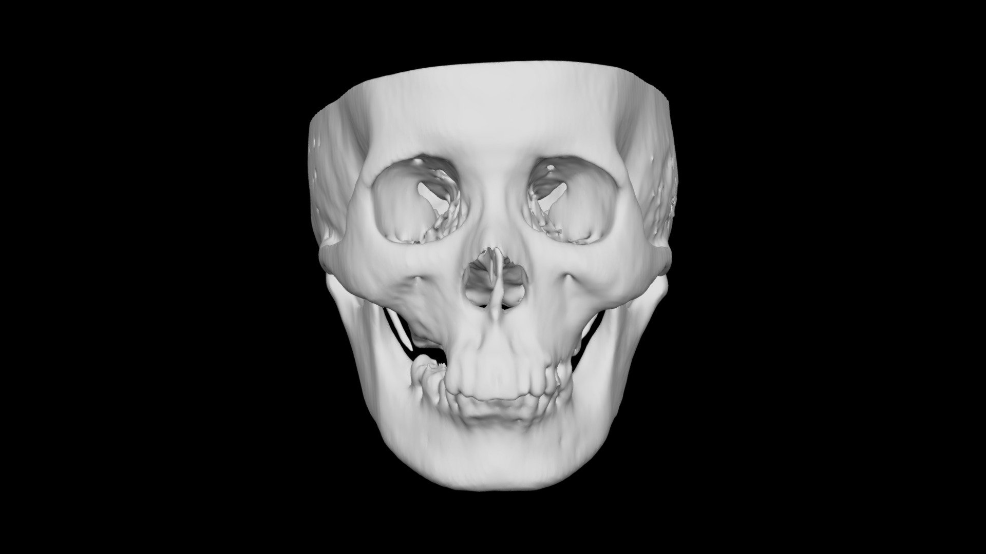 Skull Female 38yo