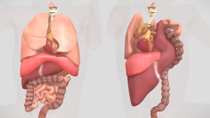 CDH Anatomy with Liver Herniation 3D Model