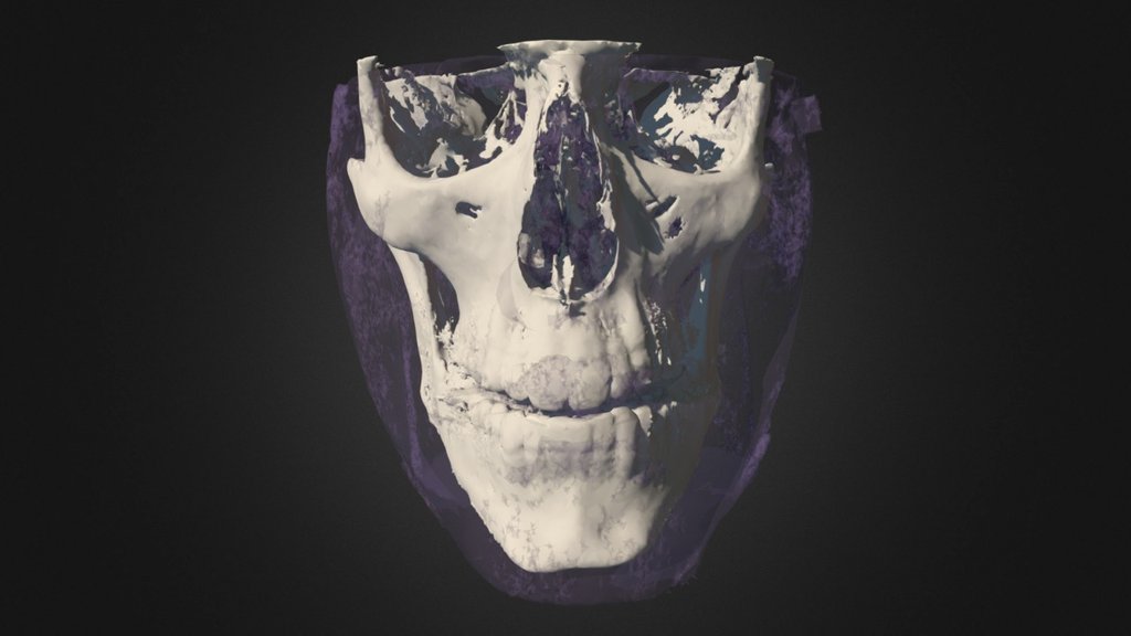 Slicer3D_Random Test
