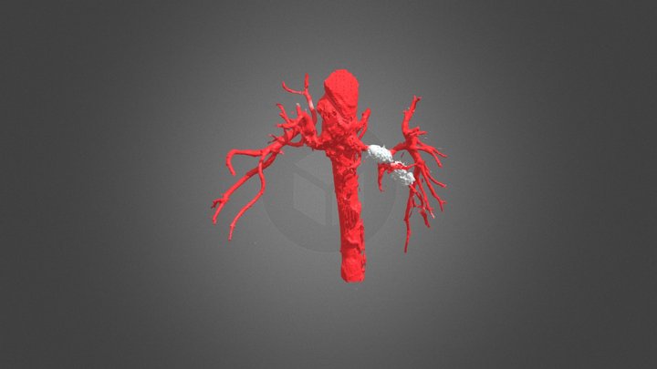 RRPP APCIVMAPCAS 3D Model