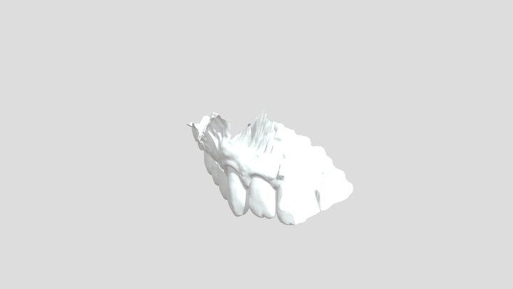 Test6_ Upper Jaw 3D Model