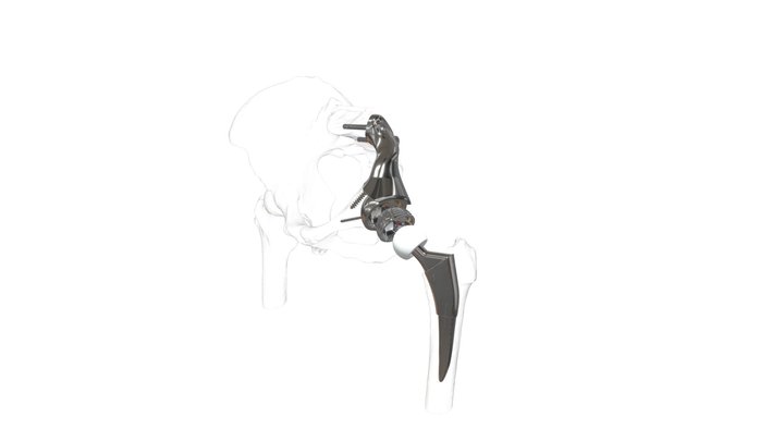 Pelvic endo-prosthesis 3D Model