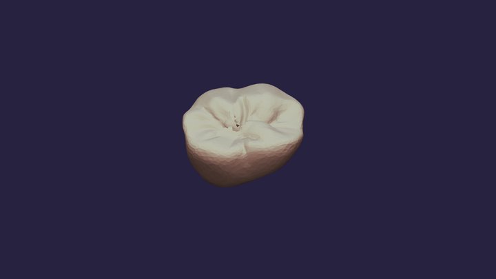 Tooth Example by ANTIROOT 3D Model