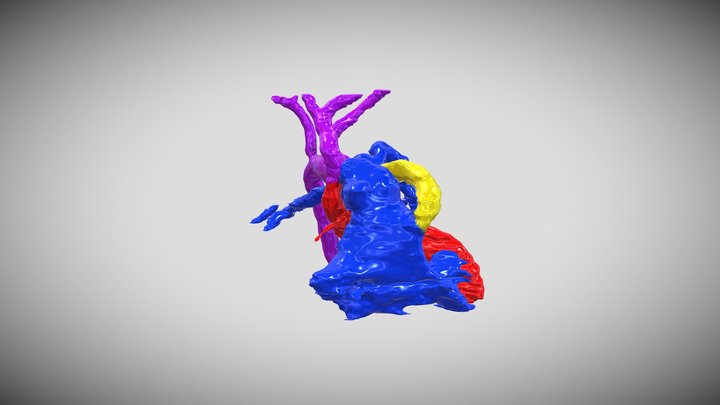 Interupted arch s/p repair 3D Model