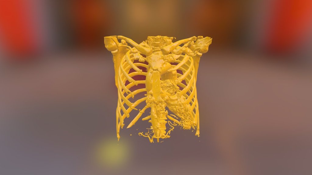 CT 0543 - In Vesalius Sample