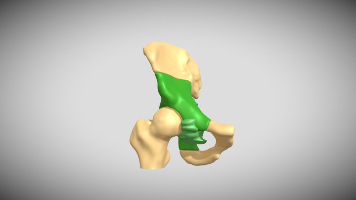 PELVIStumorFEMUR01 3D Model