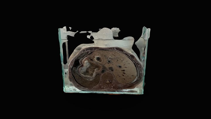 CORTE AXIAL DE ABDOMEN - NIVEL L1-L2 3D Model