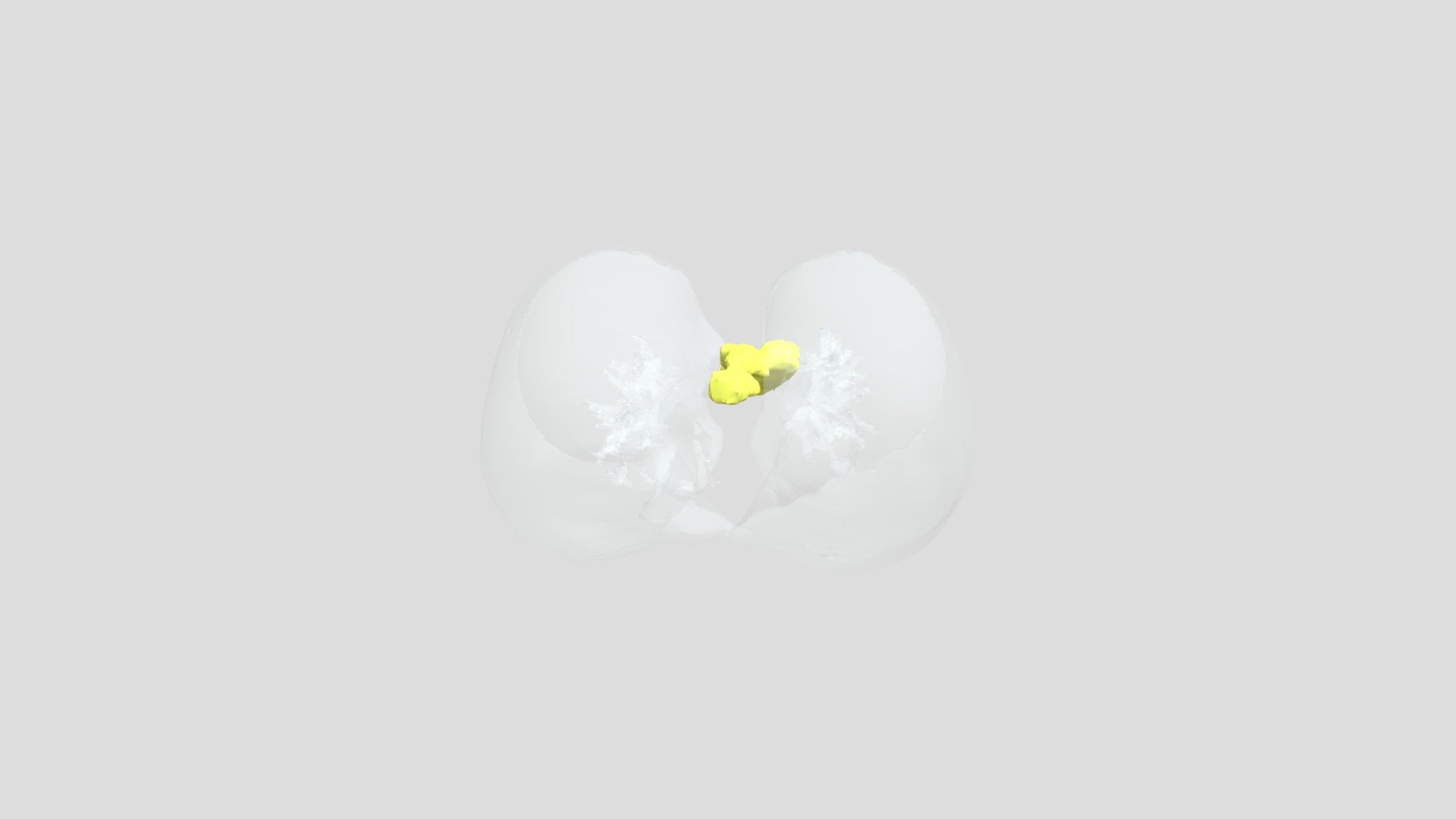 Esofago Pulmao