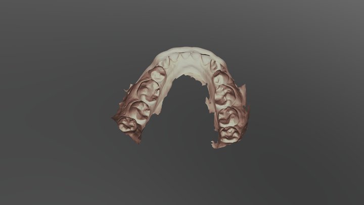 15,25 emax crown Lower Jaw Scan 3D Model
