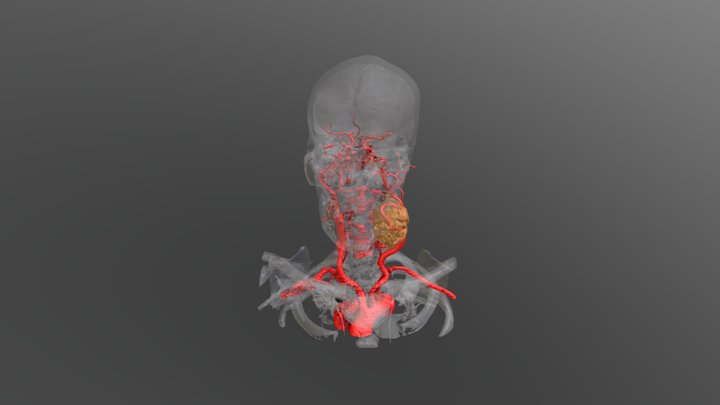 ct scan 3D Model