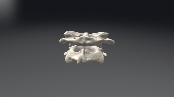 Atlas and Axis – Free 3D Model STL