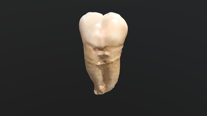 Segundo molar mandibular izquierdo (3.7) 3D Model