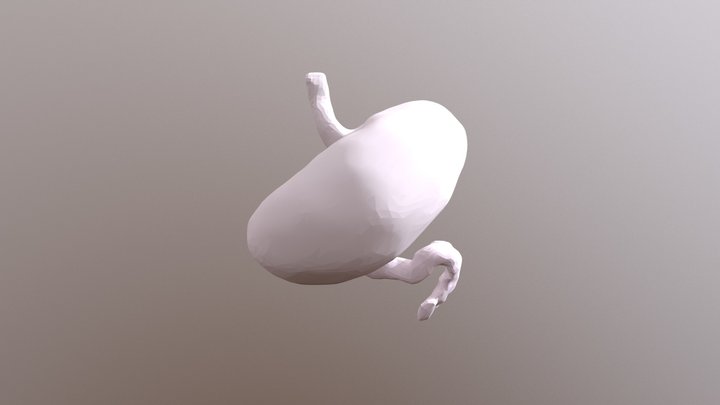 Focus Tumeur 3D Model