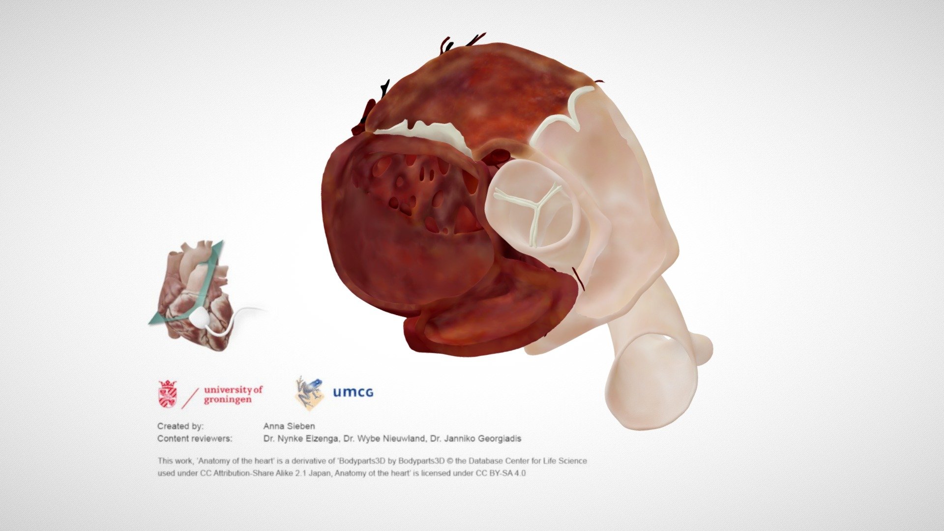 Cardiac Anatomy Psax Copy Download Free 3d Model By E Learning Umcg Elearningumcg [10d5e96