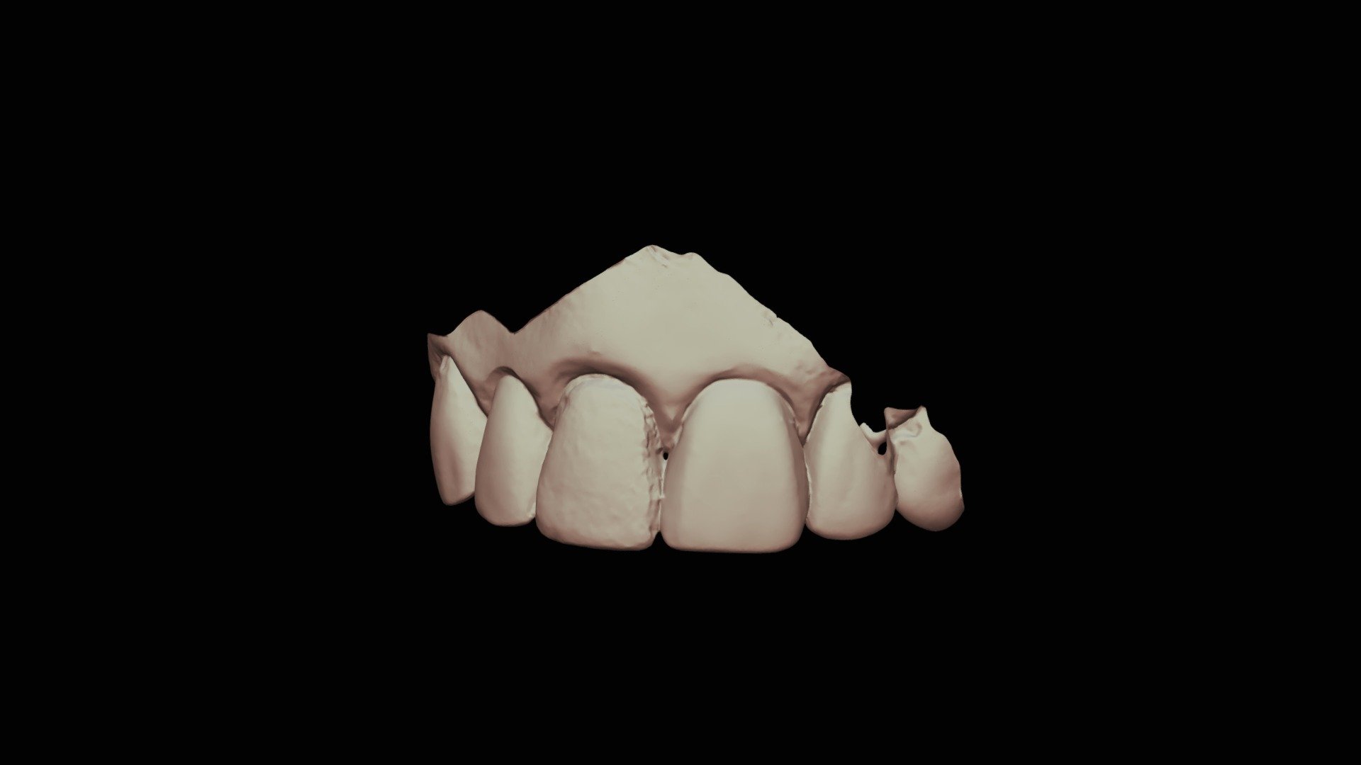 8m, Group7 Upper Jaw