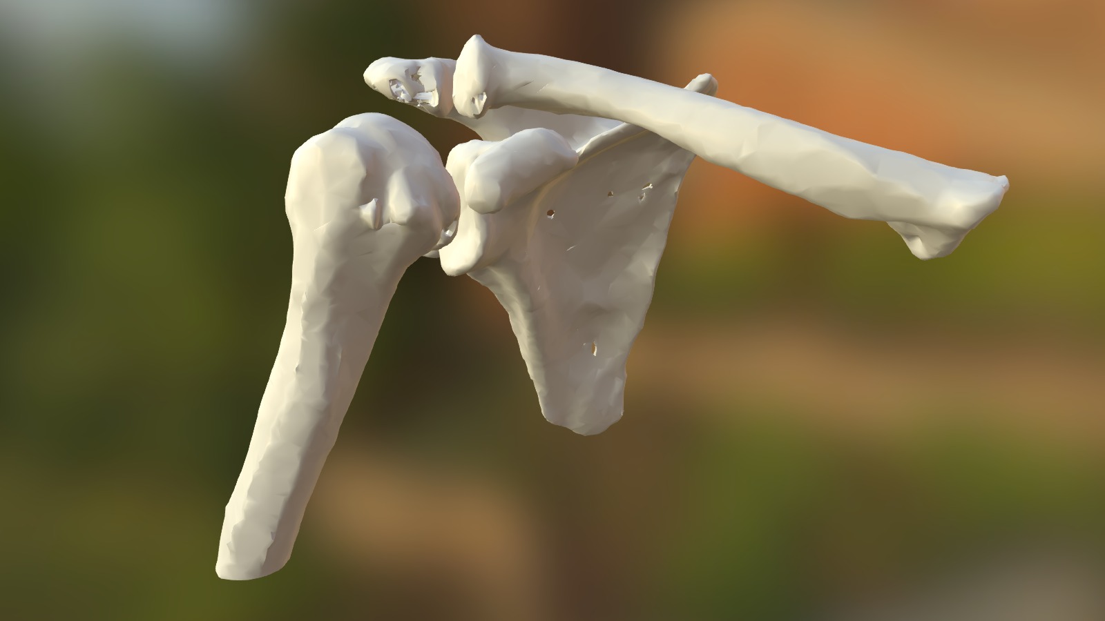 Shoulder Arthritis - sku380 - 3D model by orto3d [1113d9e] - Sketchfab