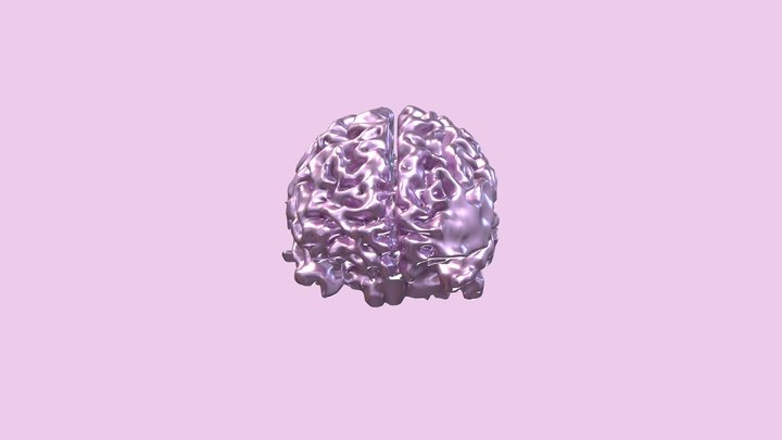 Segmentation Brain Alzheimer's Brain 3D Model