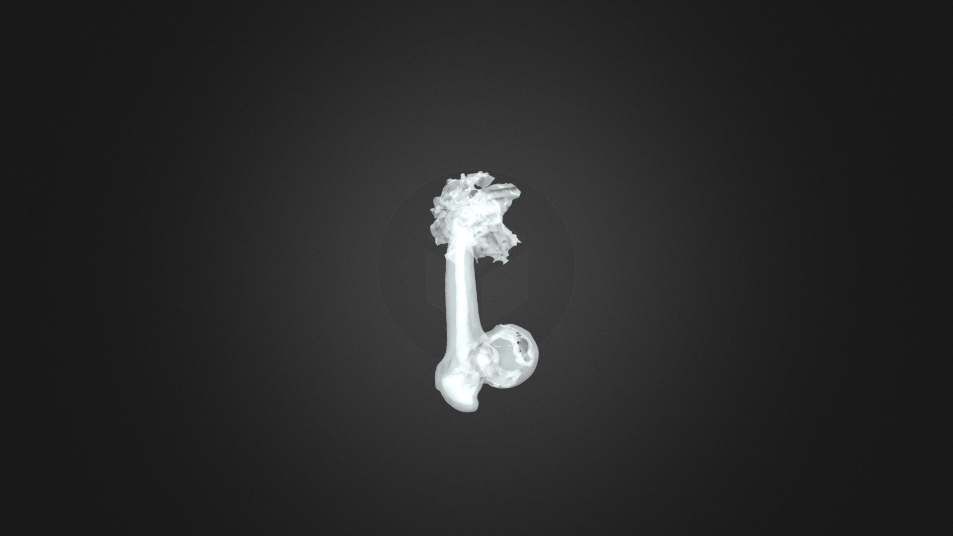 Femur