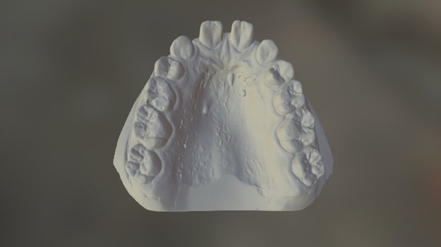 AP Upper 3D Model
