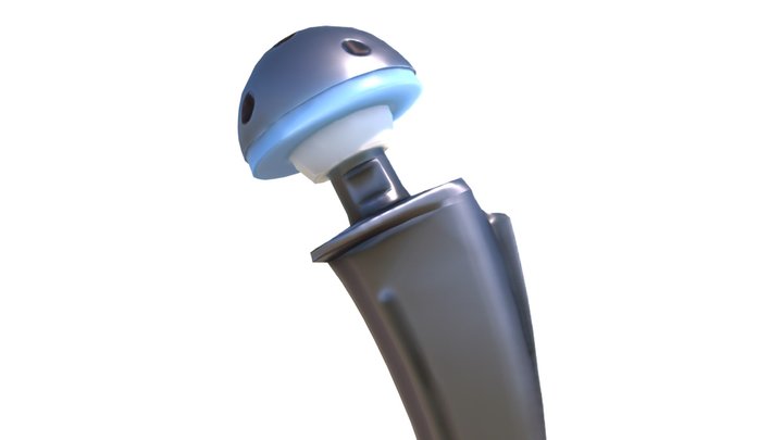 Hip Replacement Implant 3D Model