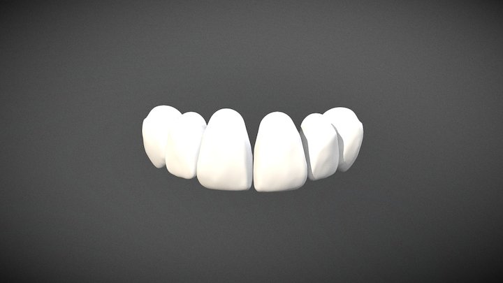 Sector Anterior 3D Model