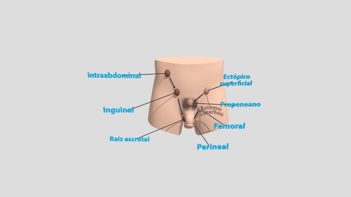DESCENSO TESTICULAR 3D Model