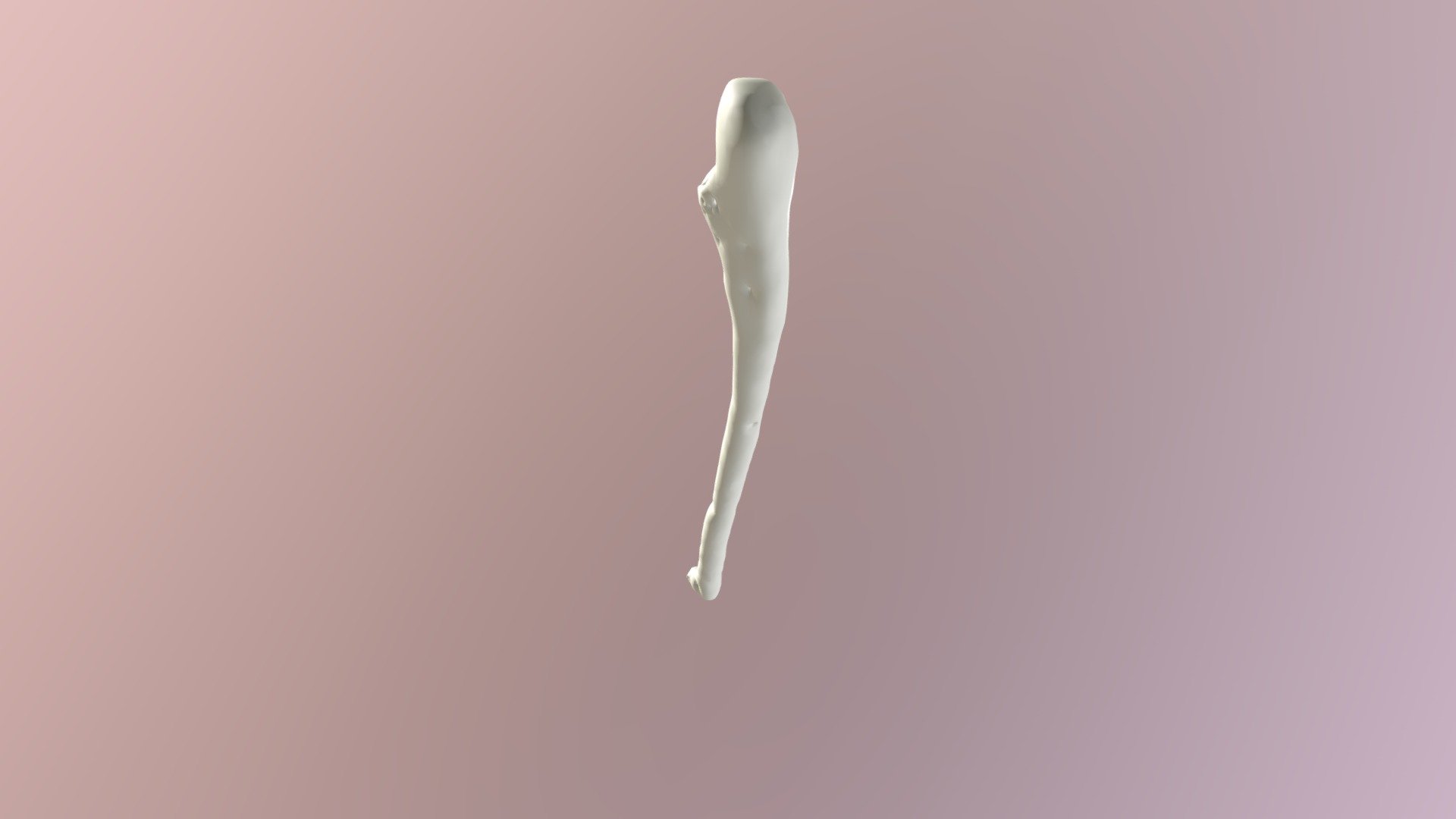 Ulna13