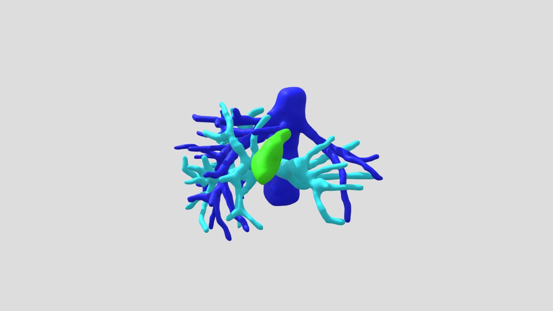 LMSB1 - 3D model by SurgiPrint [1206fe0] - Sketchfab