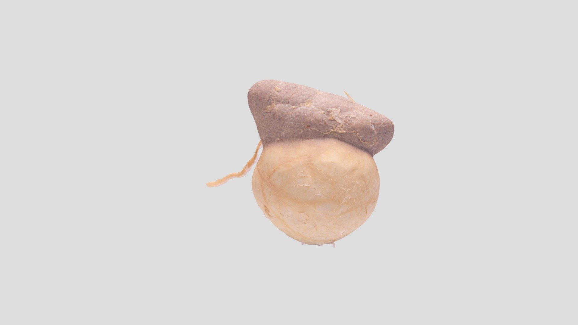 PLK_003_Kidney_Cyst - 3D model by John A Burns School of Medicine ...