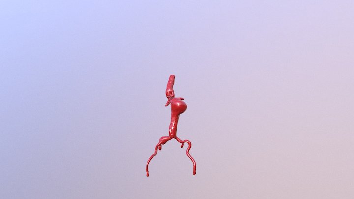 AAA-EW 3D Model