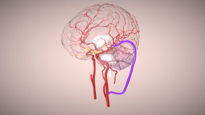 Gyri, Sulci et Arteriae | Aneurysm 3D Model
