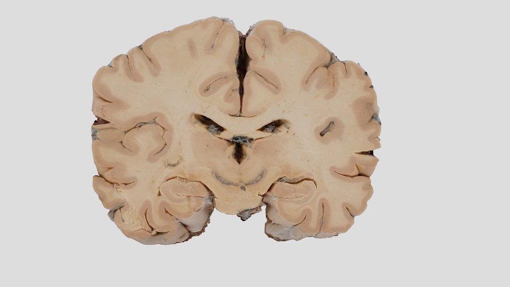 Neuroanatomy A 3D model collection by Sketchfab