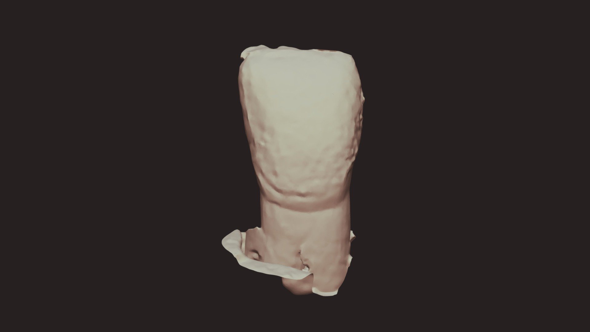 Group 6 Wax 8 B Upper Jaw