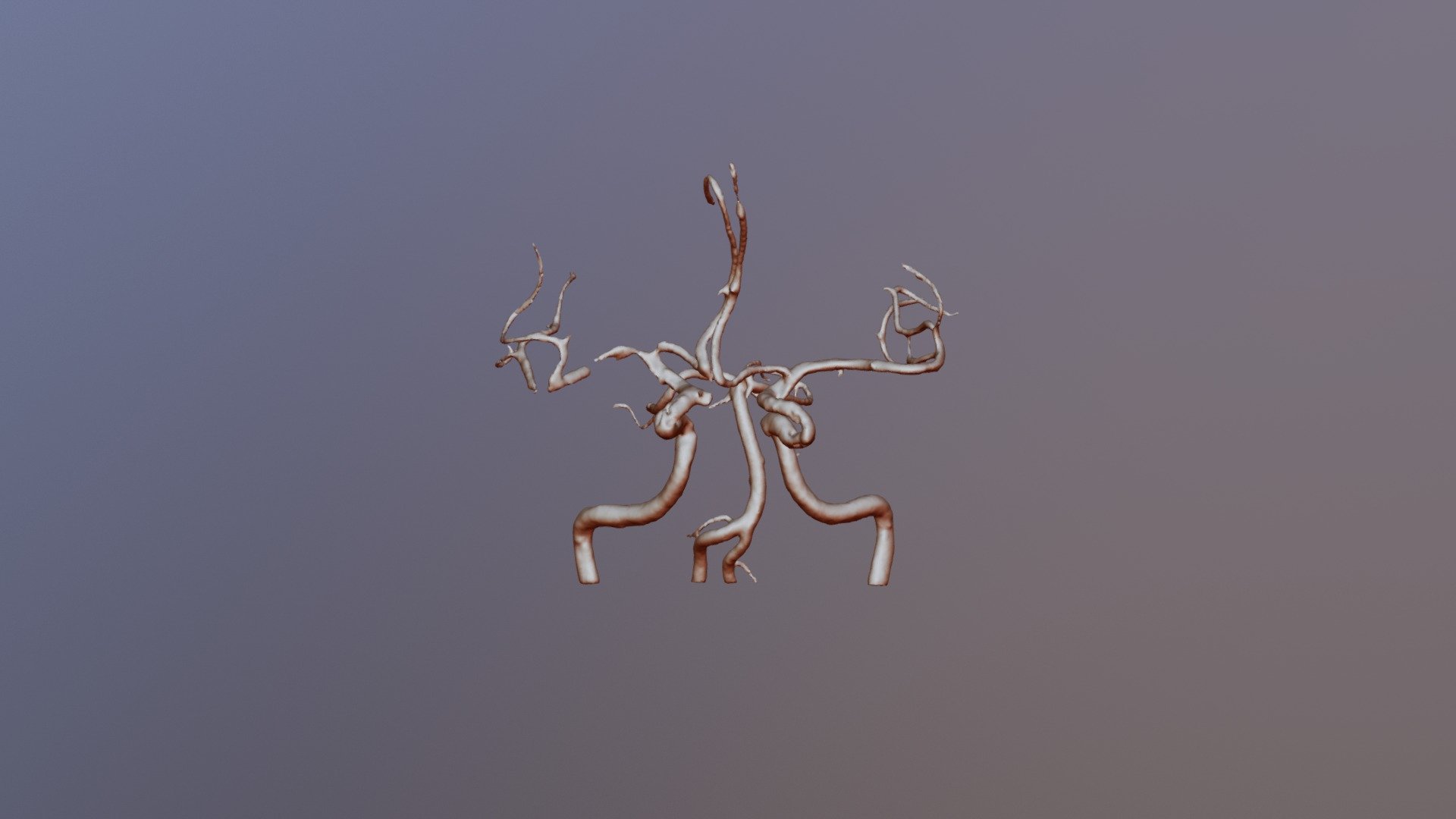 Circle Of Willis