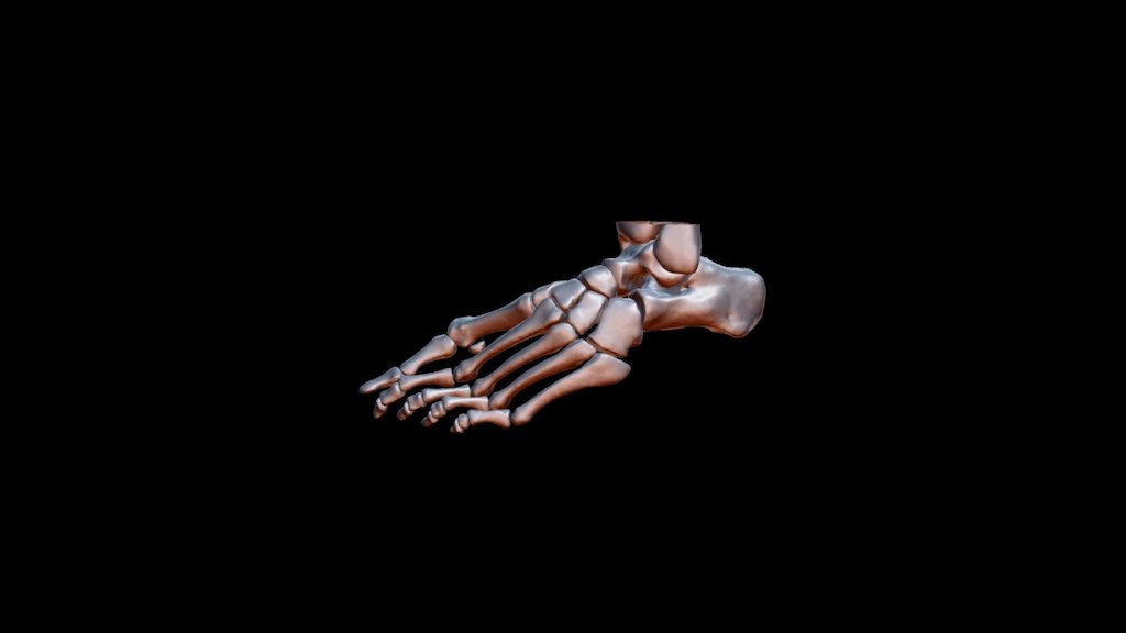 Foot Model (Skeleton) (With Bunion)