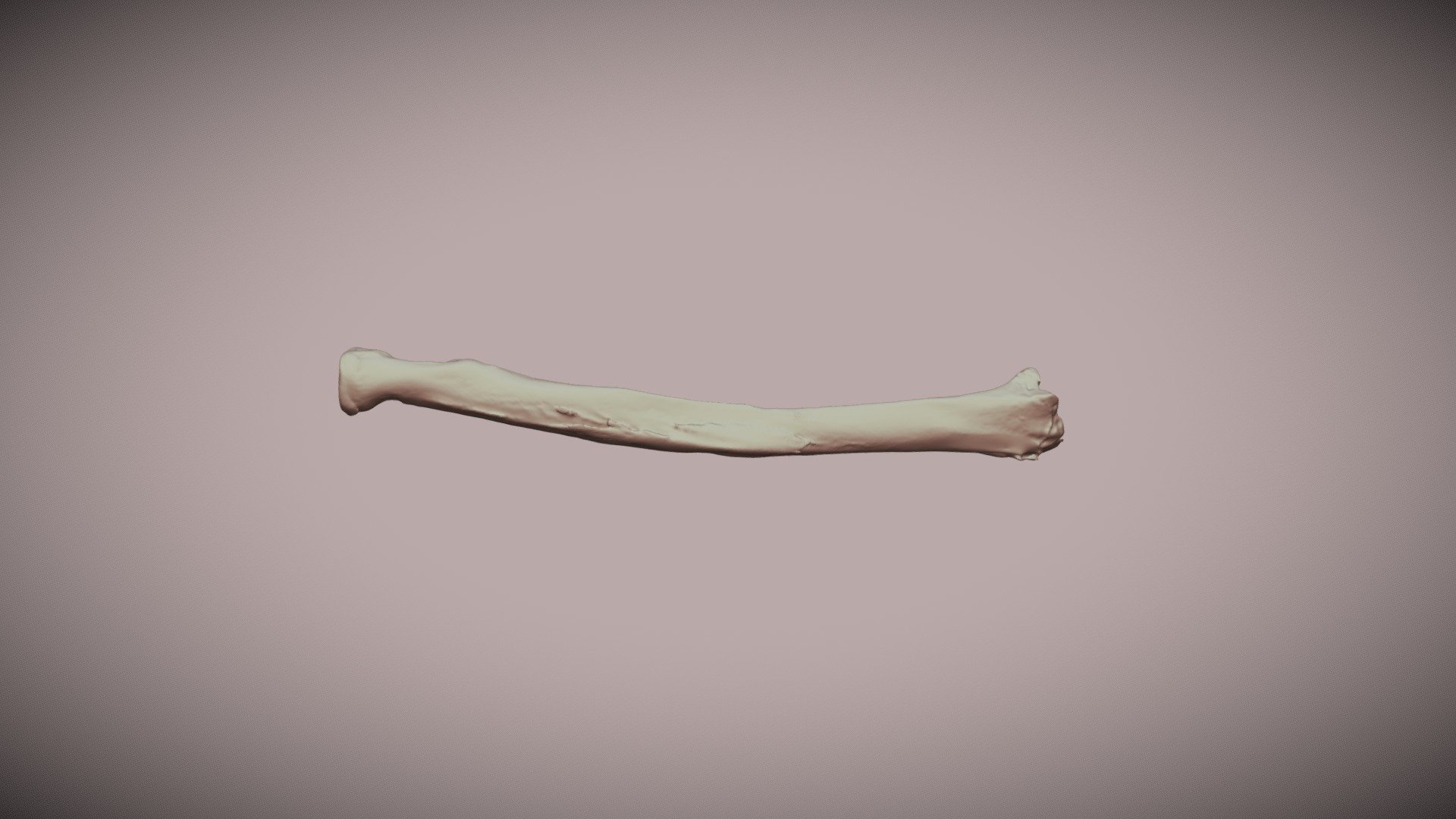 Radius Bone 3D model by OrJames Labs (orjameslabs) [13326cb] Sketchfab