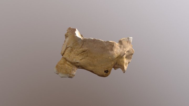 Leprosy - Maxillae (02) 3D Model