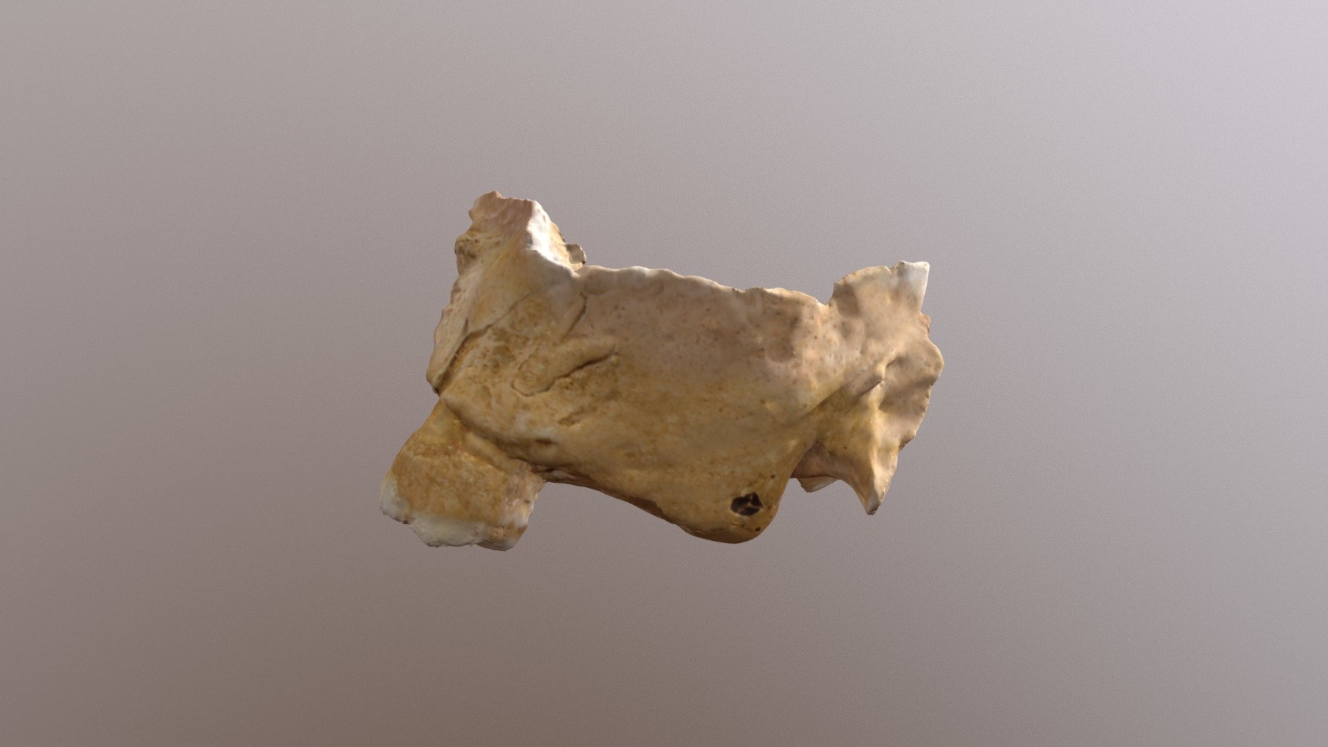 Leprosy Maxillae (02) 3D model by BU Forensic Anthropology Neil
