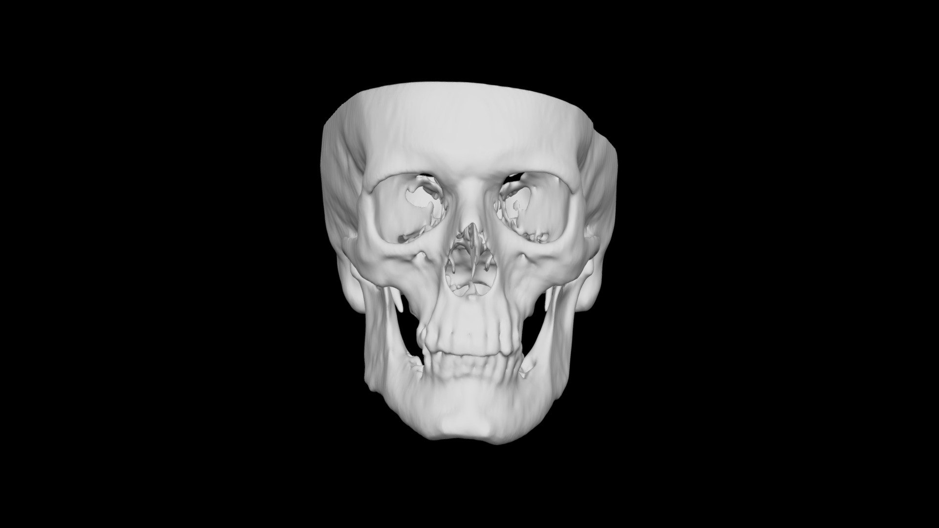 Skull Male 53yo