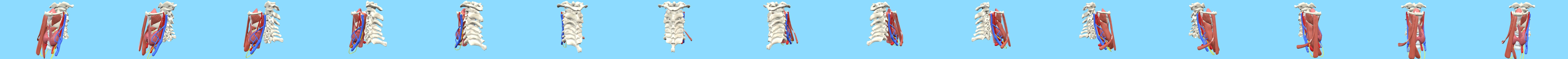 Thyroid in the neck, Hololens model 3D Model