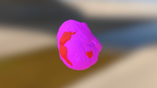 Liver with Tumours 3D Model