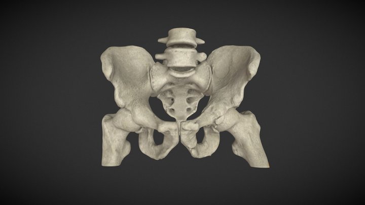Fractured Basin CT 3D Model