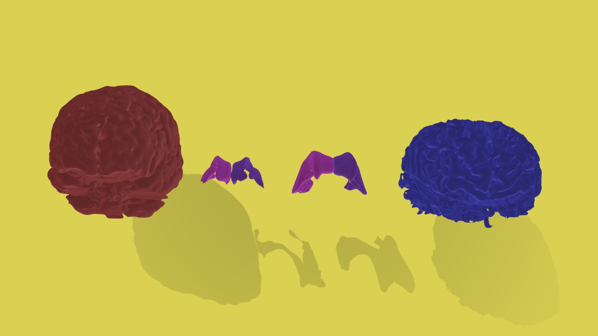 Brain and Lateral Ventricles